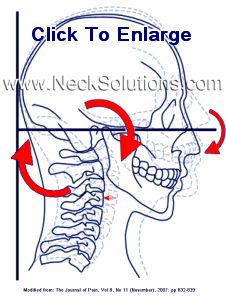 Neck Exercises Neck Exercise, Neck Pain Exercises, Upper Back Exercises, Posture Fix, Sports Physical Therapy, Text Neck, Neck Muscles, Muscle Knots