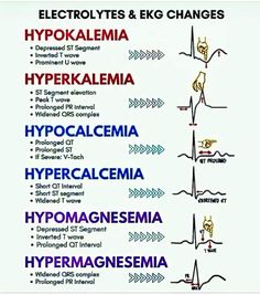 Paramedic Motivation, Er Medicine, Paramedic Tips, Nursing Theories, Ekg Rhythms, Paramedic Student, Nursing School Inspiration, Paramedic School, Nursing School Essential