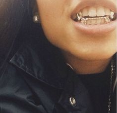 Fang Grillz, Gold Grill, Teeth Bleaching