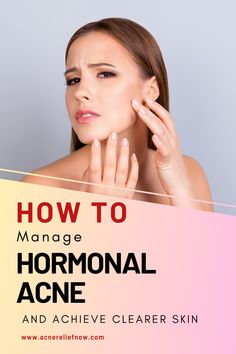 How to manage hormonal acne -Learn what causes hormonal acne, hormonal acne tips and learn natural treatment for hormonal acne. Click pin to achieve clearer skin today. Hormonal Acne Diet, Hormonal Acne Remedies, Cystic Pimple, Cystic Acne Remedies, Acne Tips, Acne Diet, Acne Skincare, Acne Skincare Routine, Types Of Acne