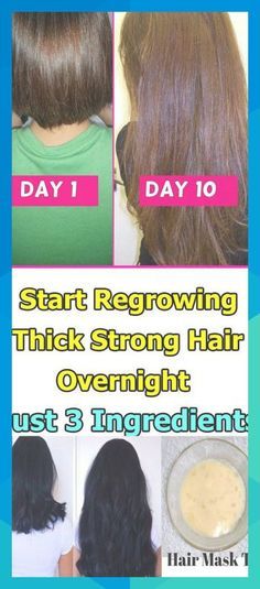 Fast Natural Hair Growth, Grow Natural Hair Faster, Thicker Stronger Hair, Get Thicker Hair, Help Hair Grow, How To Grow Your Hair Faster, Hair Care Growth, How To Grow Natural Hair, Regrow Hair