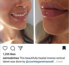 two photos of the same person's lips and nose, one has a piercing on it