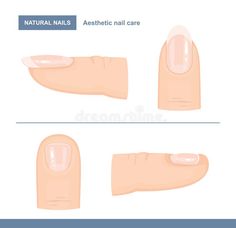 Nail Care Aesthetic, Nail Aesthetic, Different Types Of Nails, Aesthetic Nail, Care Aesthetic, Pattern Pictures