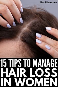 Hair loss is common in women, and this post has tons of tips to prevent and hide female balding to help you look and feel your best! Female Balding, Routine Tips, Brown Spots On Face, Female Hair, The Best Hairstyles, Bald Women, Hair Control, Brittle Hair