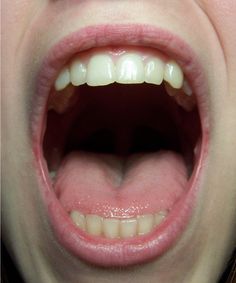 a close up of a child's mouth with white teeth