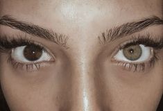 Green And Brown Heterochromia Eyes, Heterochromia Grey And Brown, Heterochromia Brown And Hazel, Hetero Chromatic Eyes, One Green One Brown Eye Heterochromia, Green Brown Heterochromia, Green And Brown Heterochromia, Brown And Green Heterochromia, Sectoral Heterochromia Brown