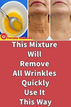 Neck Wrinkles Remedies, Face Wrinkles Remedies, Wrinkles Remedies Face, Wrinkle Remedies, Wrinkle Free Skin, Neck Wrinkles, Skin Care Wrinkles, Face Wrinkles, Skin Remedies