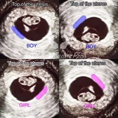 Ramzi Theory, Baby Gender Prediction, Gender Prediction, Clay Baby, Good Ideas, Pregnancy Care, Kids Discover