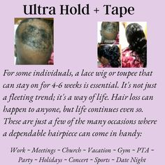 Lace Wig & Toupee Tape Adhesive Includes 3 Curve Tape Strips Ultra Hold Adhesive + Lace Front Tape Holds up to 4 Weeks or Longer Begin by applying a thin layer of Ultra Hold adhesive, and wait for it to become tacky. Place the lace wig double-sided tape on top of the thin layer of adhesive. Apply another thin layer of glue on top of the tape and wait for it to become tacky. Finally, apply a second thin layer of adhesive and allow it to become tacky before proceeding to apply the wig. Longer wait Blue Liner, Wait For It, Double Sided Tape, Blow Dry, Lace Wig, Hair Pieces, Lace Front Wigs, Lace Wigs, Lace Front