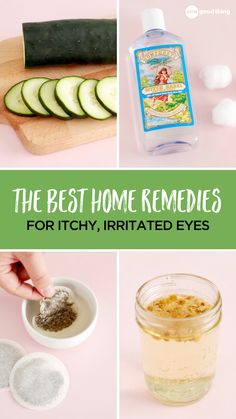 Dry Skin Around Eyes Remedies, Itchy Eyes Remedy Natural, Irritated Eyes Remedies, Eye Allergies Remedies, Dry Eyelids Remedy, Swollen Eyes From Allergies, Itchy Eyes Remedy Allergies, Dry Eyes Remedy Natural Treatments, Itchy Eyes Remedy