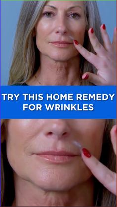 This at home remedy for aging wrinkles doesn’t require cream. Watch Now >> Clowns Scary, Best Wrinkle Filler, Strobing Makeup, Wrinkles Remedies, Home Remedies For Wrinkles, Sagging Cheeks, Mouth Wrinkles, Almond Eye Makeup, Cakey Makeup