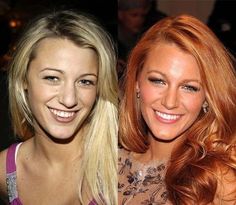 Blake Lively Nose, Nose Jobs, Rhinoplasty Surgery, Job Inspiration, Wide Nose, Nose Surgery, Celebrity Plastic Surgery, Marie Osmond