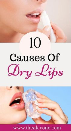 School Skin Care, Dry Lips Remedy, Chapped Lips Remedy, Very Dry Lips, Dry Lip, Cosmetology License, Lip Care Tips, Dry Cracked Lips, Health For Women