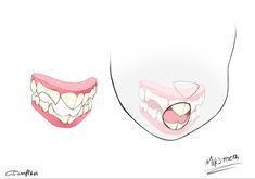 an image of teeth and gums on a white background