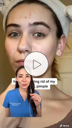 Dermatologist Reacts, Remedies For Back Acne, Adapalene Gel, Painful Pimple, Back Acne Remedies, Back Acne, Yoga Information