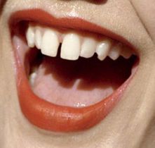 Bunny Teeth Smile Girl, Tooth Gap Aesthetic, Bunny Teeth Aesthetic, Gap Teeth Aesthetic, Smile Tips, Lindsey Wixson, Gap Teeth