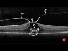 Eye Puns, Skeletal System, Human Eye, Skeletal, Ultrasound, A Series