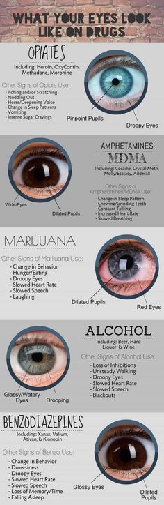 an info sheet showing the different types of eyes