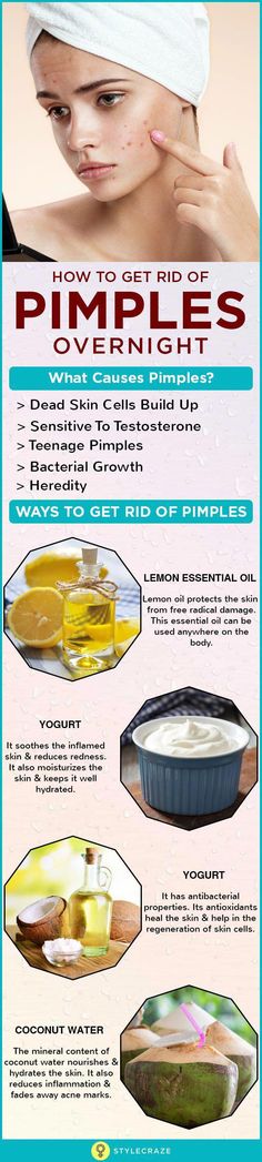 Skincare Simple Tips to Prevent Pimples - DocPe Skincare Simple Tips to Prevent Pimples What Causes Pimples, Remove Pimples Overnight, Rid Of Pimples, Acne Overnight, Pimples Overnight