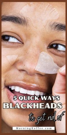 Here are five effective and detailed methods that you can use to quickly and effectively eliminate blackheads and achieve clearer, smoother skin Egg White Mask, Rid Of Blackheads, Pore Strips, White Mask, Get Rid Of Blackheads, Egg White