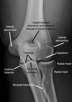 the bones of the lower limb are labeled in black and white, with labels on them