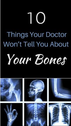 Osteoporosis Diet, Osteoporosis Exercises, Osteoporosis Prevention, Bone Healing, Strong Bones, Good Bones, Benefits Of Exercise, Bone Density, Healthy Bones