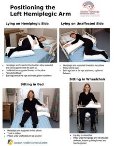 Positioning for hemiplegic arm Repinned by SOS Inc. Resources http://pinterest.com/sostherapy. Hemiplegia Occupational Therapy, Hemiparesis Occupational Therapy, Occupational Therapy Adults, Hemiplegia Activities, Inpatient Rehab Occupational Therapy, Acute Care Occupational Therapy, Nursing Aide, Physical Therapist Assistant