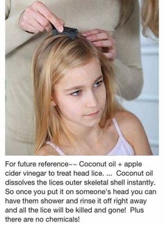 Lice tx. Braggs Apple Cider, Health Coconut Oil, Coconut Oil Uses, Simple Life Hacks, Diy Life Hacks, Useful Life Hacks, Health Remedies, Household Hacks, Apple Cider