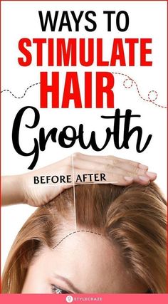 Ways To Stimulate Hair Growth: While a dermatologist can help you find the right treatment options, trying certain effective natural remedies does not hurt. Here, we discuss various simple methods you may use to stimulate your hair growth naturally. Keep reading. #haircare #hairgrowth #haircaretips Help Hair Grow, Home Remedies For Hair, Mega Hair, New Hair Growth, Grow Hair Faster, Stimulate Hair Growth, Hair Growth Tips