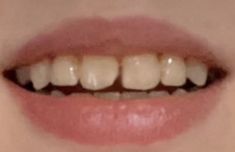 Perfect Teeth Aesthetic Vampire, Yellow Teeth Smile, Nice Teeth Smile Aesthetic, Teeth Astethic, Cute Crooked Teeth, Canine Teeth Aesthetic, Perfect Teeth With Fangs