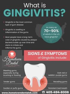 Early Adulthood, Swollen Gum, Dental Hygiene School, Dental Facts, Dental Marketing, Teeth Health, Receding Gums