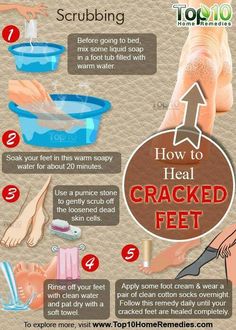 Diy Pedicure, Pedicure At Home, Foot Scrub, Foot Soak, Healthy Routine