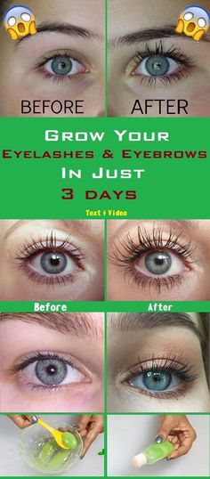 Nails Grow Faster, Grow Your Eyelashes, Obličejové Masky, Eyelashes And Eyebrows, Eyebrow Serum