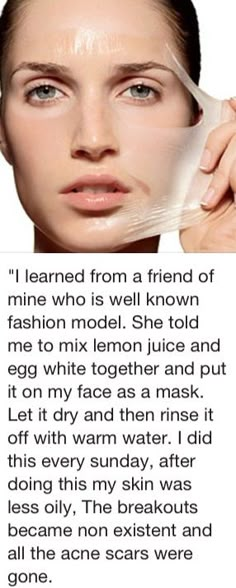 Egg white mask - Was reading about how this is great for blackheads...going to try it out myself. Egg White Mask, Home Remedies For Acne, Trening Fitness, Acne Remedies, Smokey Eyes, Egg White, Face Skin Care, Health And Beauty Tips