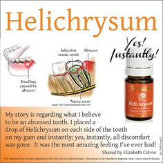 essential oils for dental care Abcessed Tooth, Young Living Helichrysum, Helichrysum Essential Oil, Young Living Essential Oils Recipes, Oil Remedies, Essential Oils Herbs, Essential Oils Health, Yl Essential Oils, Living Essentials Oils