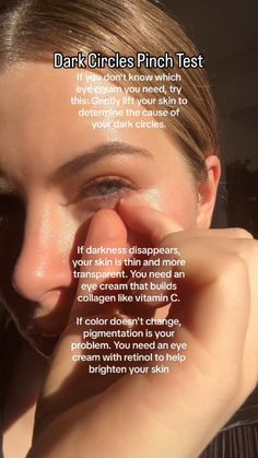 How To Treat Dark Circles, How To Not Have Dark Circles, Dark Cycles Under Eyes, Purple Under Eye Circles, Types Of Dark Circles, How To Fix Eye Bags, How To Treat Dark Circles Under Eyes, How To Fix Under Eye Bags, How To Fix Dark Circles