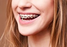 Healthy Snack Ideas for People With Braces? — Good Questions | The Kitchn People With Braces, Healthy Snack Choices, Family Dental Care, Good Questions, Healthy Snack Ideas, Teeth Straightening, Family Dentist, Family Dental, Dental Services