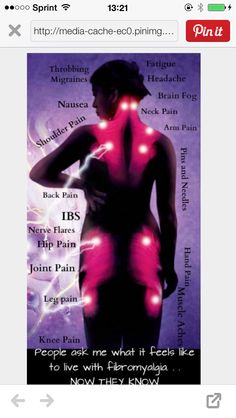 Fatigue Symptoms, Leg Pain, Migraine Headaches, Hip Pain, Leg Muscles, Natural Supplements