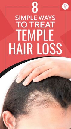 Thinning Hair At Temples Women, Wig Tutorials, Hair Shedding Remedies, Natural Hair Remedies, Natural Hair Growth Remedies, Herbs For Hair, Brown Spots On Face, Hair Remedies For Growth, Hair Growth Supplement