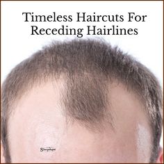 Short Hair Men Receding Hairline, Mens Hairstyles Receding Hairline Thinning Hair Men Haircuts, Buzz Cut For Receding Hairline, Mens Thinning Hairstyles Short, M Hairline Hairstyles Men, Hair Cuts For Receding Hairline Men, Classic Male Haircut, Men’s Hair Cuts For Receding Hairline, Men’s Haircuts For Receding Hairline