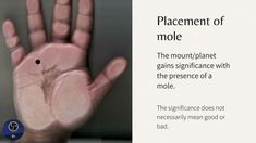 IF-YOU-HAVE-A-MOLE Mole Placement Meaning, Mole Meaning, Red Moles, Longevity Diet, Lower Back Pain Exercises, Daily Yoga Workout, Secrets Of The Universe, Palm Reading, Daily Yoga