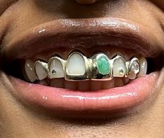 Diamond Teeth, Gold Grillz, Grills Teeth, Gold Teeth, Tooth Gem, The Bling Ring