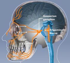 the head and neck are labeled with orange wires in each part of the brain, which is connected to blood vessels