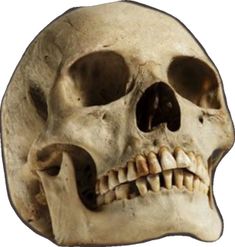 an image of a human skull with no lower jaw and one eye missing from it