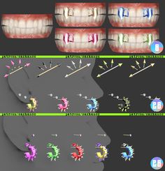 the different stages of tooth decay and how to fix them with dental care products in 3ds max