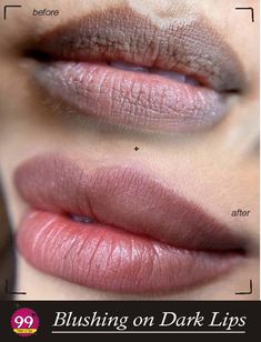 Lip color on dark lips includes neutralization of dark spots & making the colors of the lips indeed via tattooing them. Appearance is that the most vital thing in life. People do tons of things to take care of their appearance. DO VISIT @@99 International Salon FOR MORE DETAILS ☎️ US ON 8️⃣4️⃣3️⃣7️⃣6️⃣0️⃣1️⃣2️⃣3️⃣4️⃣ Exclusive offers valid 15th October 2022 #BeautySalon #BridalMakeup #PartyMakeup #HairDo #BeautyParlour #ProfessionalMakeup #NailExtensions #HairExtensions #BeautyParlour #BeautySal Hydra Gloss Lips, Gloss Lips, Frames Design Graphic, Lips Gloss, Eyebrow Design, Permanent Makeup Eyebrows