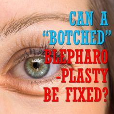 Can “Botched” Blepharoplasty be fixed? https://charlesthornemd.com/blogs/ #cosmeticsurgery #plasticsurgery #facelift #plasticsurgeon #beauty #aesthetics #facialplasticsurgery #septorhinoplasty #surgeon #doctor #cosmetic #medical #blogging #brow #brows #eyebrows #antiaging #surgery