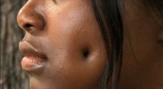 Ndu Enuwa News Joint: Woman’s Face Deformed After Getting Fake Dimple   ... Healthy Morning Routine, Winter Recipes, Nerve Pain, Healthy Diet Plans, Lower Back, Fashion Tees, Healthy Diet