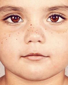 a young boy with freckles on his face