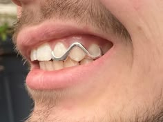 a close up of a man's teeth with a metal brace